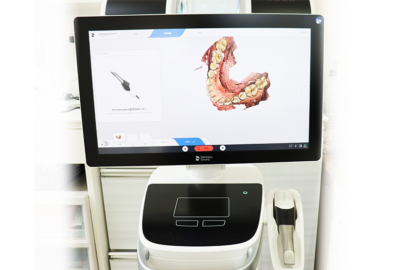 口腔内スキャナー