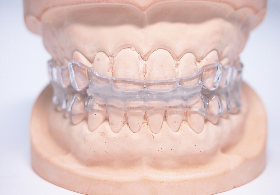 スリープスプリント（睡眠時無呼吸症候群治療）
