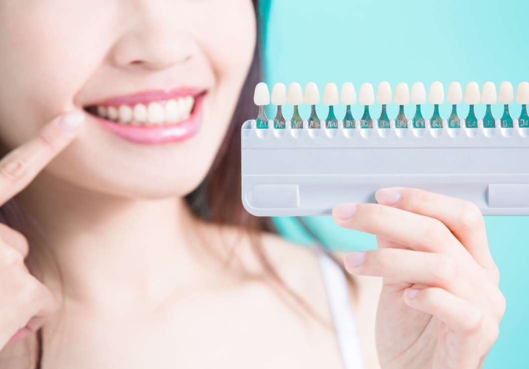 ホワイトニング