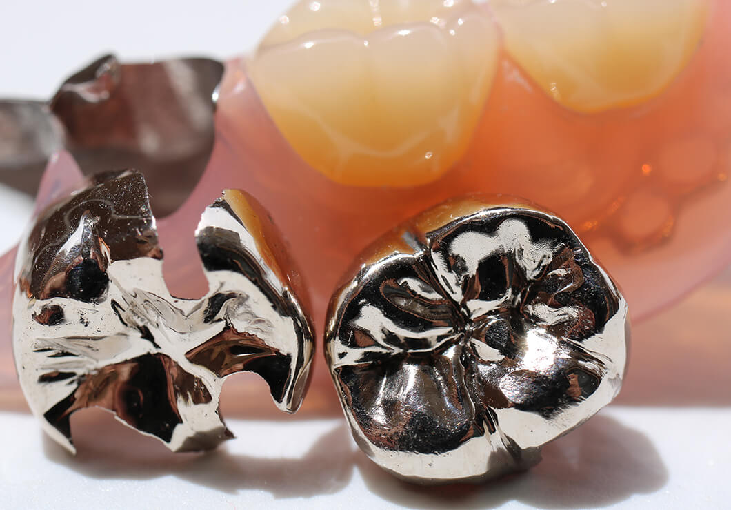 保険診療について