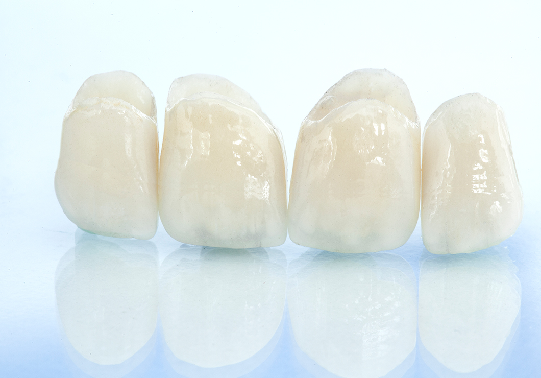 自由診療について