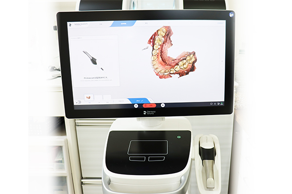 口腔内スキャナー
